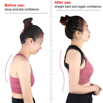 Posture Corrector - Back Support